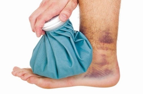Chườm lạnh để xử trí bong gân, sai khớp đúng cách