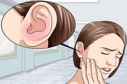 Ở giai đoạn sớm, bệnh nhân ung thư vòm họng thường bị ù tai một bên