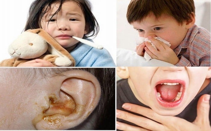 Bí quyết phòng bệnh tai mũi họng mùa lạnh