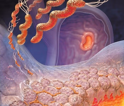 cách nhận biết vi khuẩn HP kháng thuốc