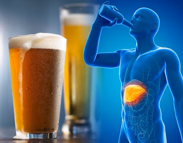 5 lý do khiến người Việt dễ mắc ung thư gan