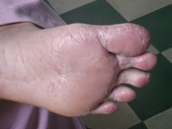 phòng khám thu cúc có khám da liễu không được nhiều người quan tâm