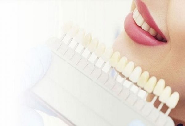 Làm răng thẩm mỹ ở đâu tốt