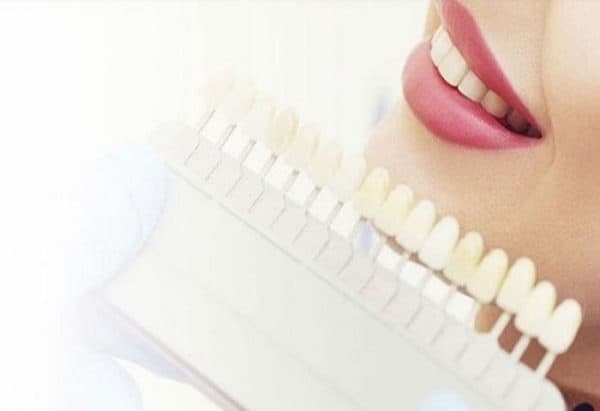 Làm răng thẩm mỹ ở đâu tốt