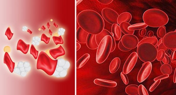 bệnh thalassemia khi nào cần đi khám