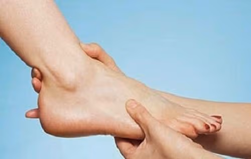 Triệu chứng giãn dây chằng cổ chân dễ phát hiện