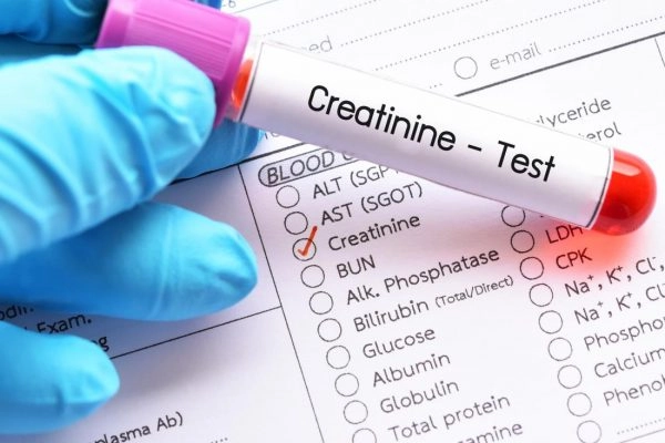 định lượng creatinine máu phản ánh điều gì?