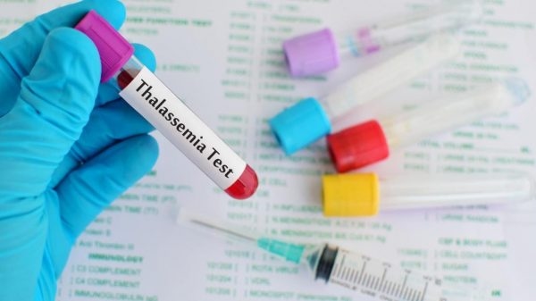 xét nghiệm máu giúp phát hiện những bất thường để phát hiện sớm bệnh thalassemia