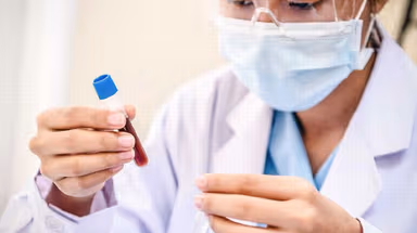 Urobilinogen là gì? Chỉ số Urobilinogen cao