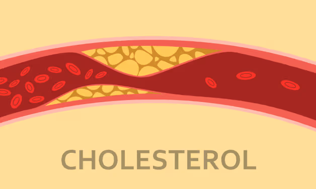 Cholesterol trong máu cao coi trừng mắc bệnh về tuyến giáp