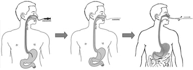 Nội soi dạ dày qua đường mũi có chính xác không?