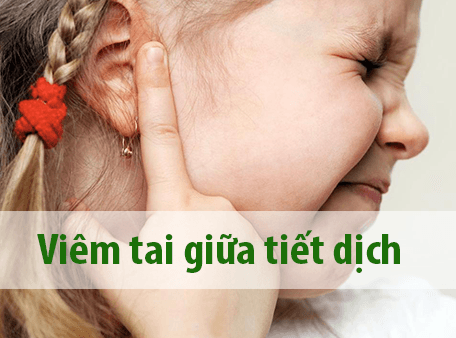 biểu hiện bệnh viêm tại giữa tiết dịch