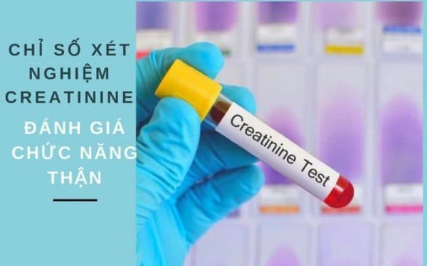 xét nghiệm chức năng thận