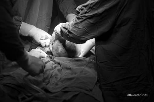 sinh con còn nguyên bọc ối