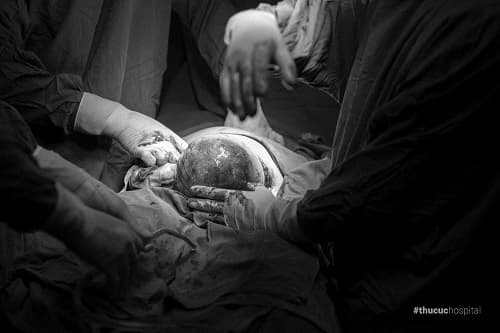 sinh con còn nguyên bọc ối