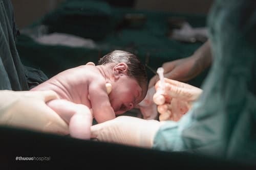 sinh con còn nguyên bọc ối