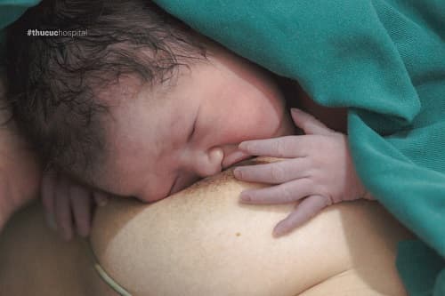 sinh con còn nguyên bọc ối