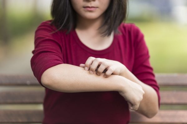 Những người bị bệnh Parkinson, liệt mặt, người nhiễm HIV, sử dụng một số thuốc thần kinh, suy dinh dưỡng, thiếu kẽm, sang chấn tâm lý, những người có cơ địa dễ dị ứng,… dễ mắc viêm da tiết bã nhờn hơn những người không bị các bệnh này