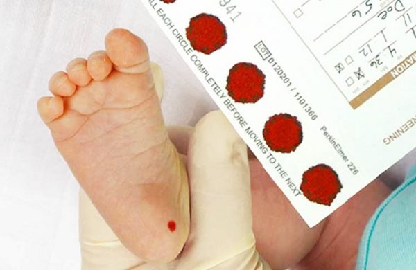 xét nghiệm chứng rối loạn bẩm sinh