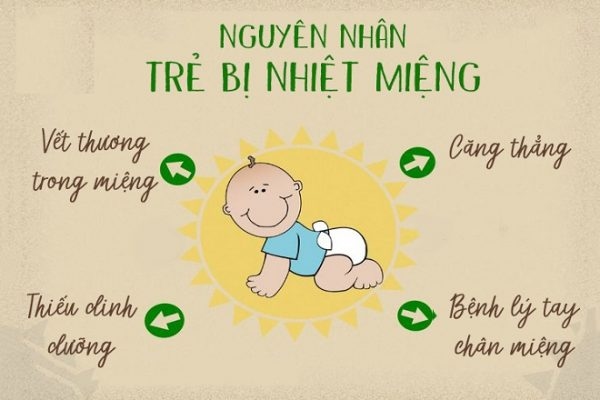 nhiệt miệng là một dạng gây loét niêm mạc miệng thường gặp ở trẻ