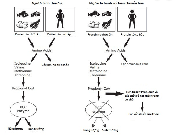 rối loạn chuyển hóa bẩm sinh