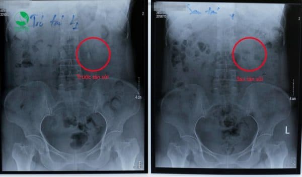 soi-than-to-co-the-het-sach-khong-can-mo-nho-dot-pha-cong-nghe-moi3
