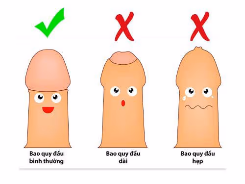 vì sao nên cắt bao quy đầu cho bé