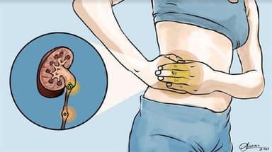 Sỏi thận khám ở đâu? có thêm những thông tin hữu ích