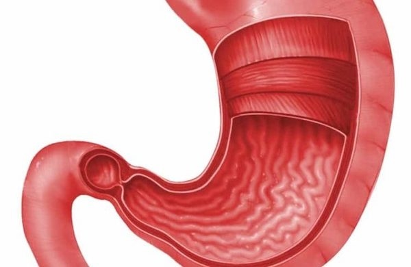 viêm dạ dày có nguy hiểm không