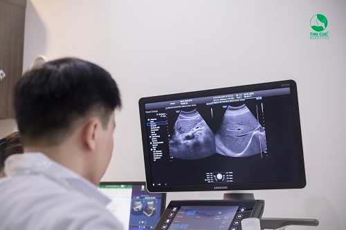 Tại bệnh viện Thu Cúc có hệ thống thiết bị máy siêu âm hiện đại với hình ảnh rõ nét