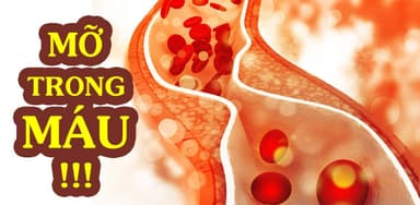 Tăng mỡ máu và tăng men gan cần có chế độ ăn như nào