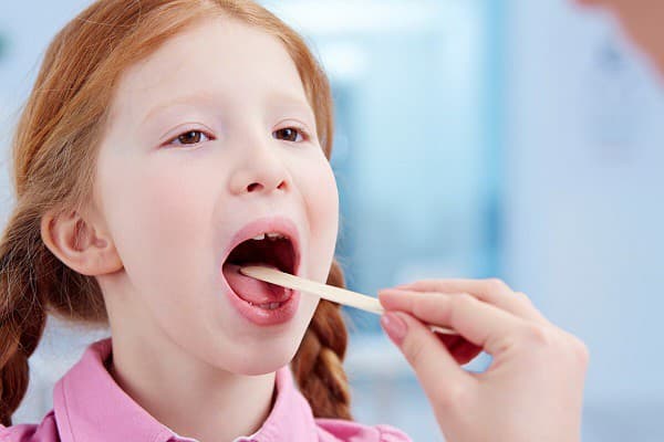 Viêm amidan ở trẻ