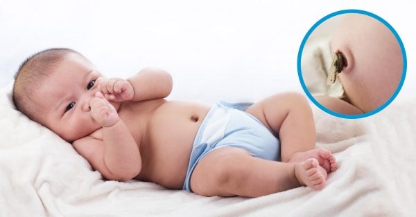 chăm sóc rốn cho trẻ sơ sinh cần lưu ý những điều gì