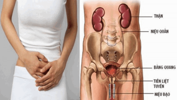 bệnh viêm đường tiết niệu có tự khỏi không