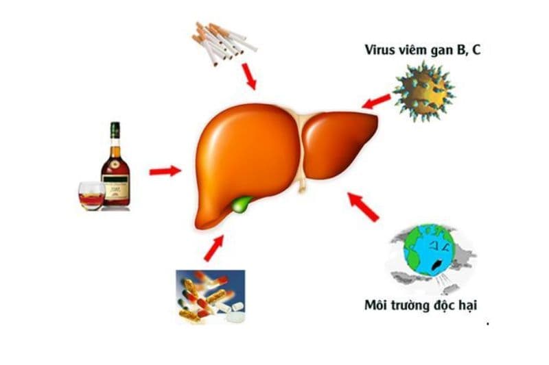 Nguyên nhân gây viêm gan virus