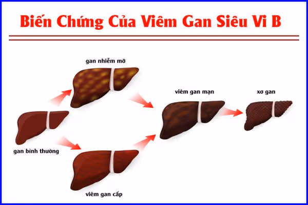 hội thảo gan mật tại Thu Cúc