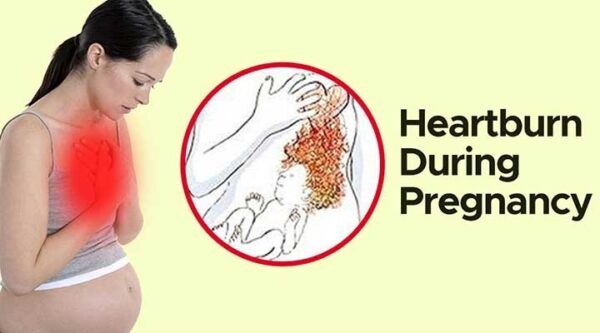 Ợ nóng, ợ hơi là triệu chứng của trào ngược dạ dày thực quản - một trong các rối loạn tiêu hóa khi mang thai