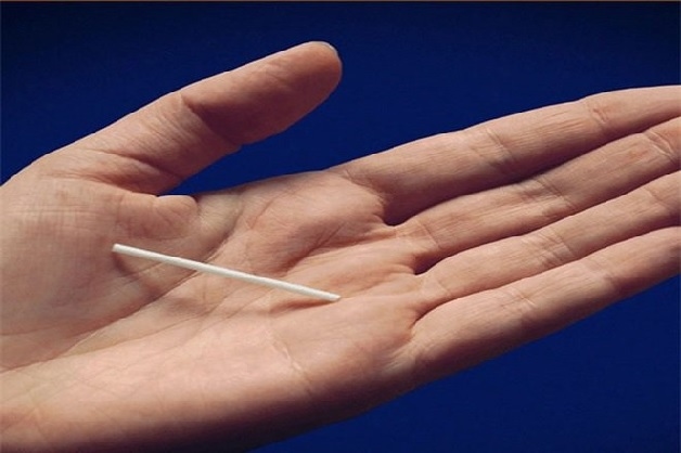 Nhược điểm của cấy que tránh thai là không phòng ngừa được bệnh lây nhiễm qua đường tình dục