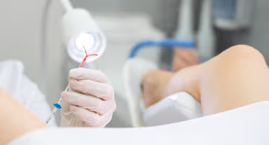 Tháo vòng tránh thai và những điều chị em cần biết