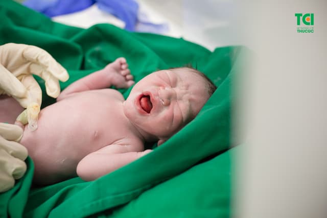 Cận cảnh ca mổ dây rốn thắt nút tại Bệnh viện Thu Cúc