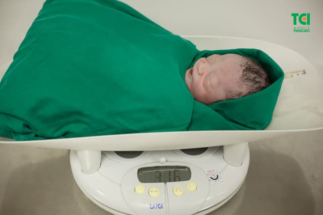 Cận cảnh ca mổ dây rốn thắt nút tại Bệnh viện Thu Cúc