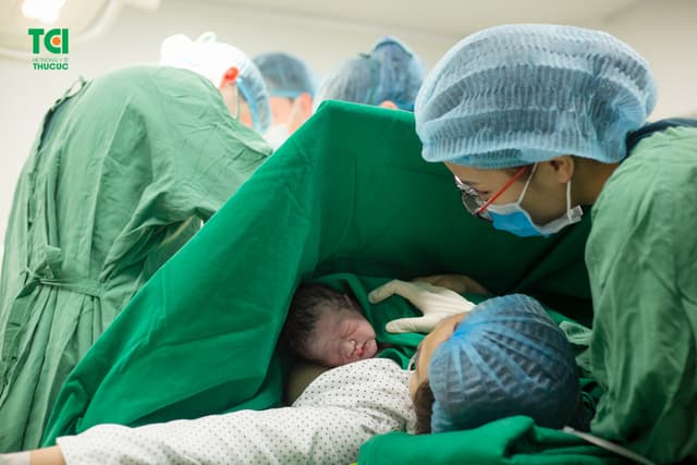 Cận cảnh ca mổ dây rốn thắt nút tại Bệnh viện Thu Cúc