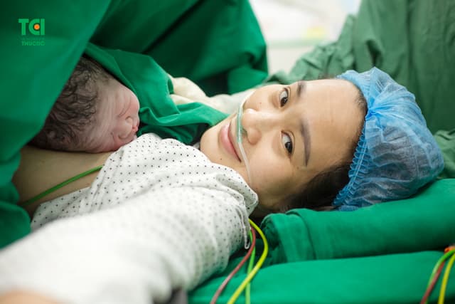 Cận cảnh ca mổ dây rốn thắt nút tại Bệnh viện Thu Cúc