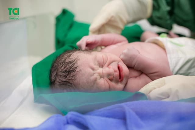 Cận cảnh ca mổ dây rốn thắt nút tại Bệnh viện Thu Cúc