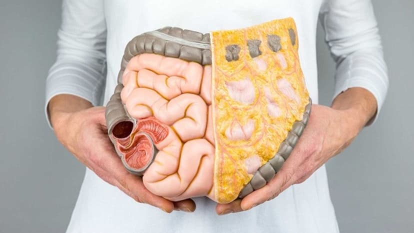 Điều bạn cần biết về xét nghiệm tầm soát ung thư CEA