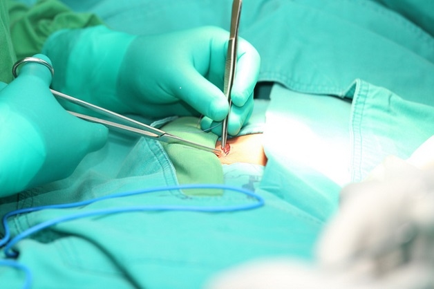 Thoát vị bẹn trực tiếp và gián tiếp - Cách điều trị