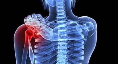 Tổng hợp kiến thức y khoa về tầm soát ung thư xương