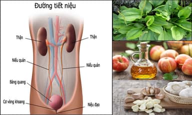 Viêm tiết niệu uống nước gì để hỗ trợ điều trị bệnh?