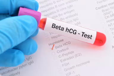 Góc giải đáp: Xét nghiệm beta HCG có ý nghĩa như thế nào?