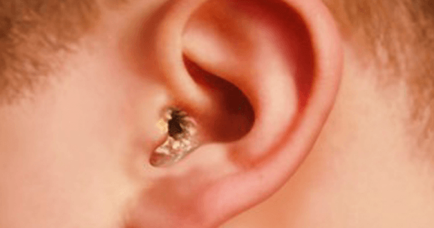 Tầm quan trọng của việc chữa viêm tai dứt điểm